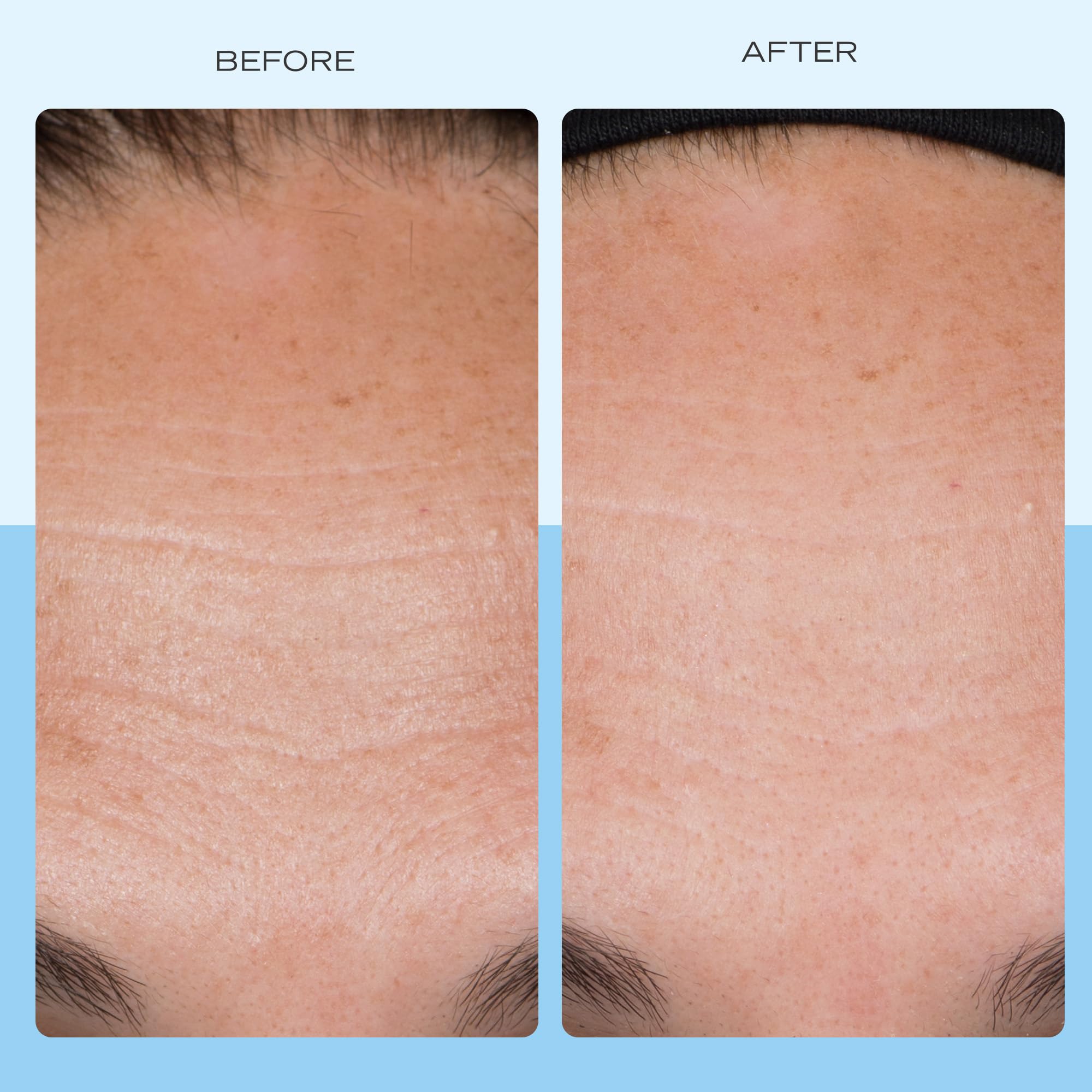 First Aid Beauty ingrédients collagène, peptides et niacinamide pour teint homogène.