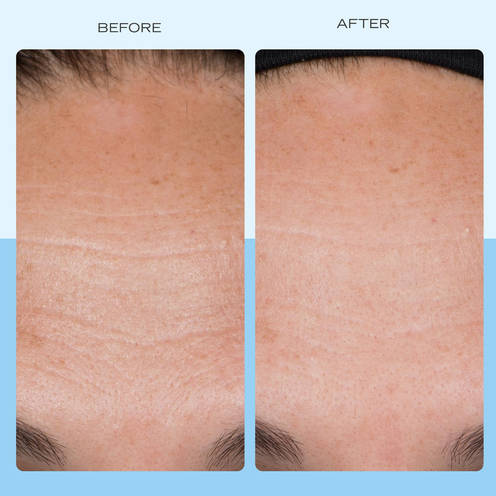 First Aid Beauty ingrédients collagène, peptides et niacinamide pour teint homogène.