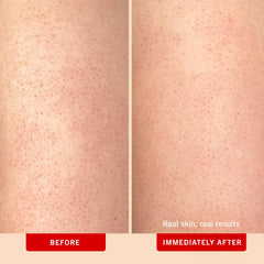 First Aid Beauty KP Bump Eraser; billes de pumice pour éliminer les rugosités.