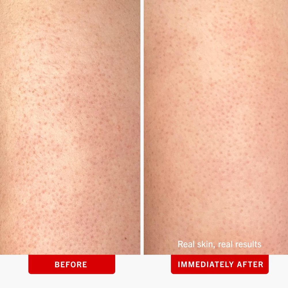 Grains de pierre ponce visibles dans le KP Bump Eraser, exfoliation sans microplastique