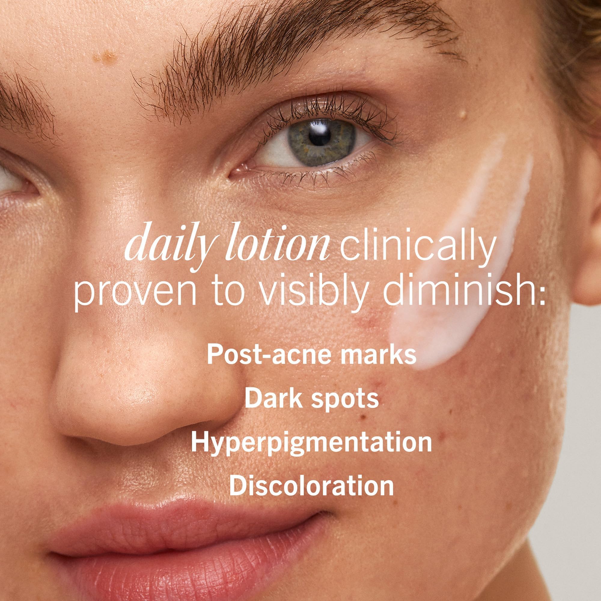 First Aid Beauty niacinamide deux pourcent – visage, uniformise le teint.