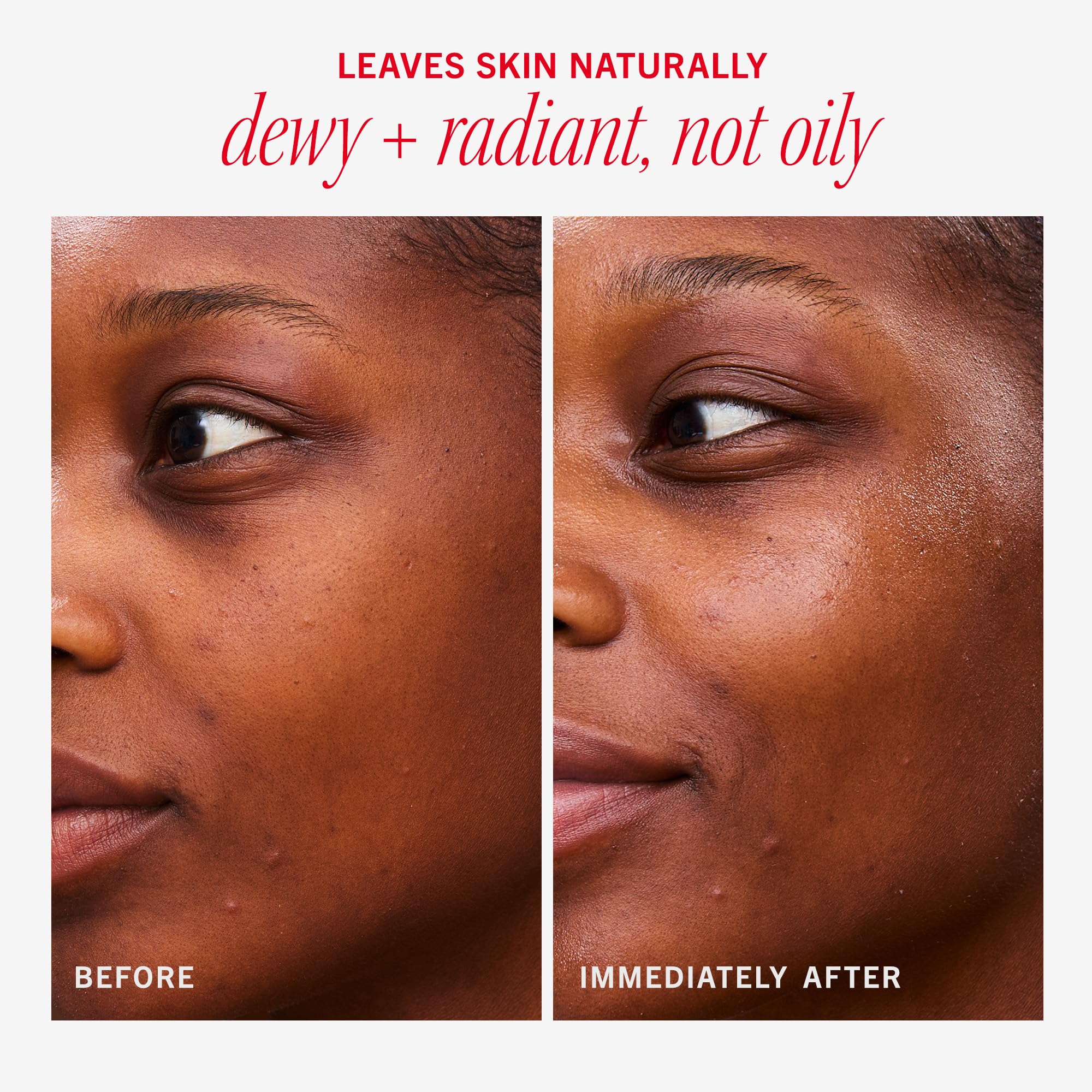 Dermatologue testé, formule sans parfum et sans irritants.