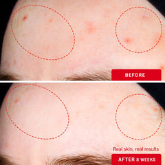 First Aid Beauty texture légère – hydratation durable sans surcharger les pores.