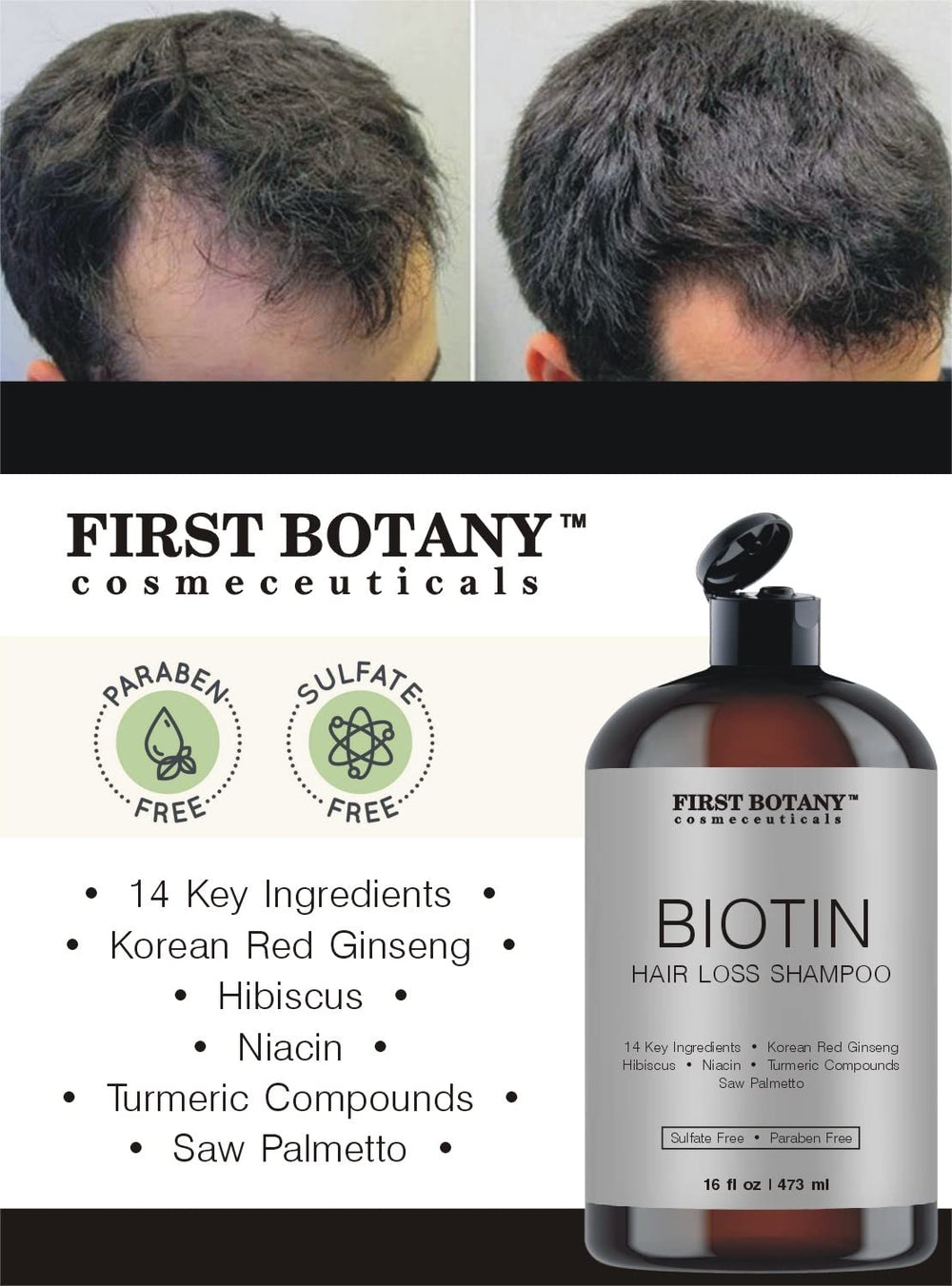 First Botany Shampoing nourrissant — convient à tout type de cheveux et cuir chevelu