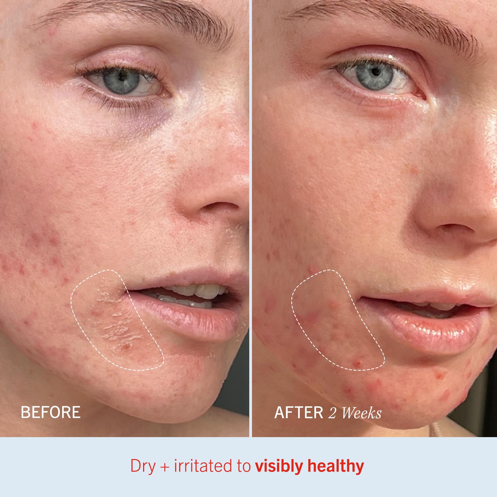 Formule vegan et sans cruauté dans First Aid Beauty Ultra Repair Cream.