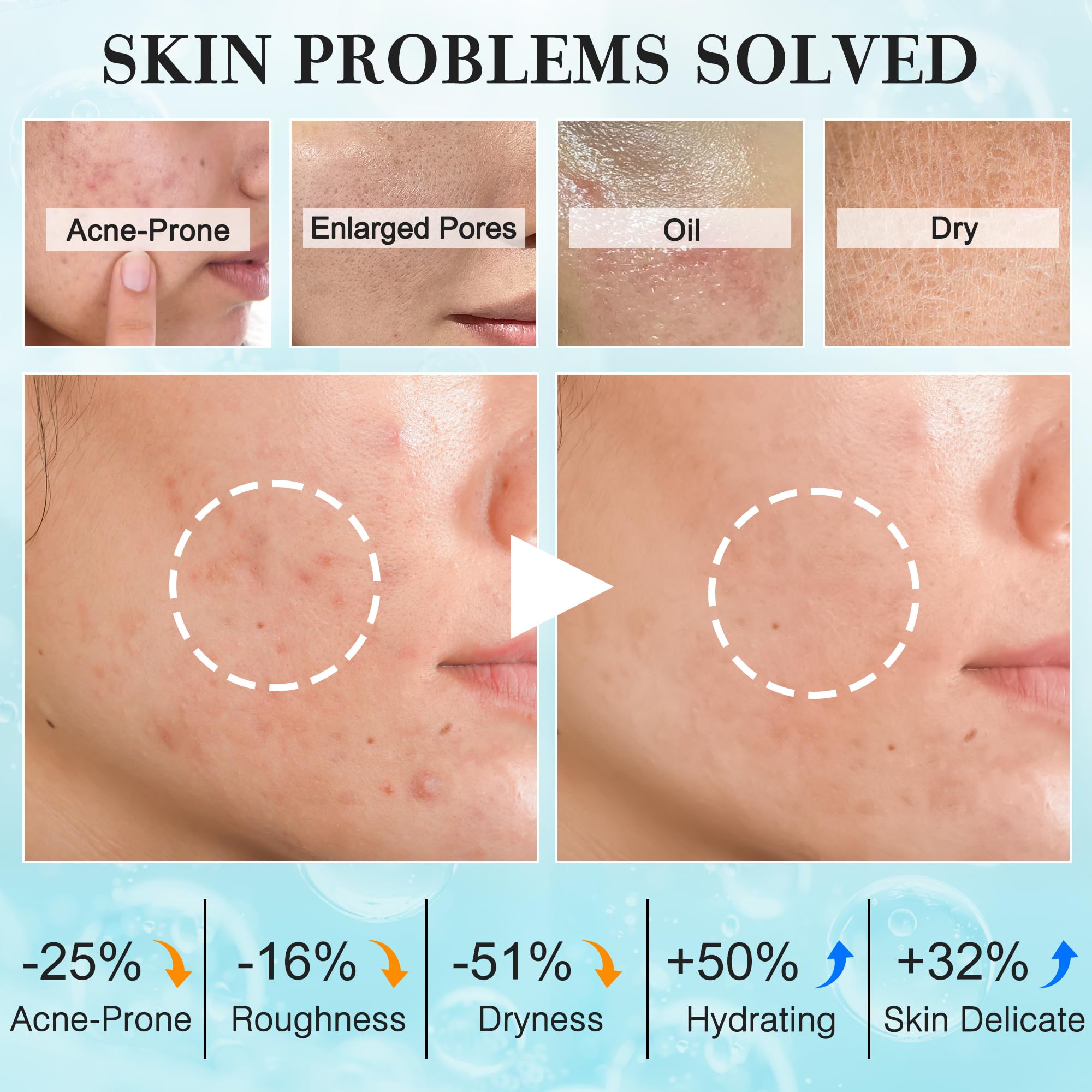 FITOEG tonique équilibre peau : réduit les brillances et resserre les pores.
