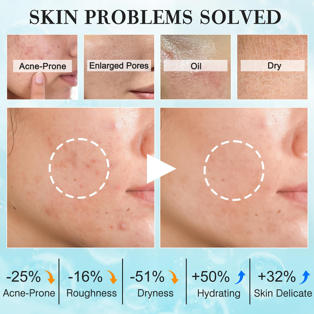 FITOEG tonique équilibre peau : réduit les brillances et resserre les pores.