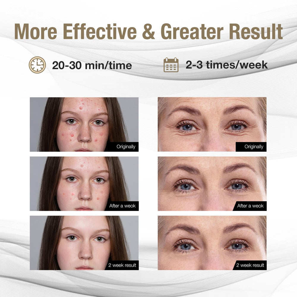 Le masque F FIWENE offre un ajustement ergonomique pour une couverture lumineuse optimale.