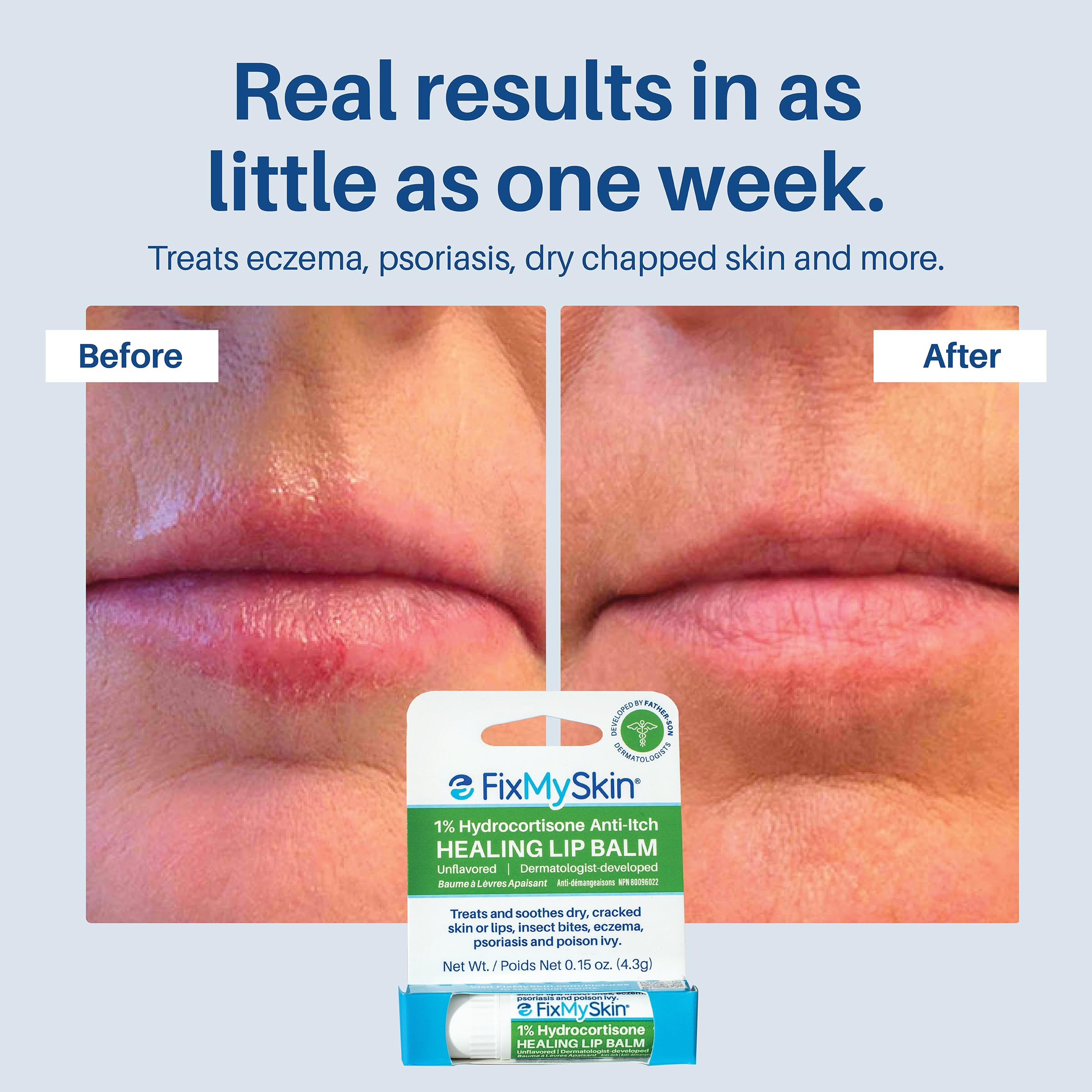 FixMySkin travel-friendly lip balm in pocket for everyday protection.