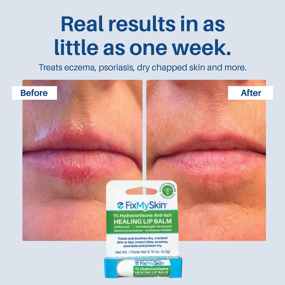 FixMySkin travel-friendly lip balm in pocket for everyday protection.
