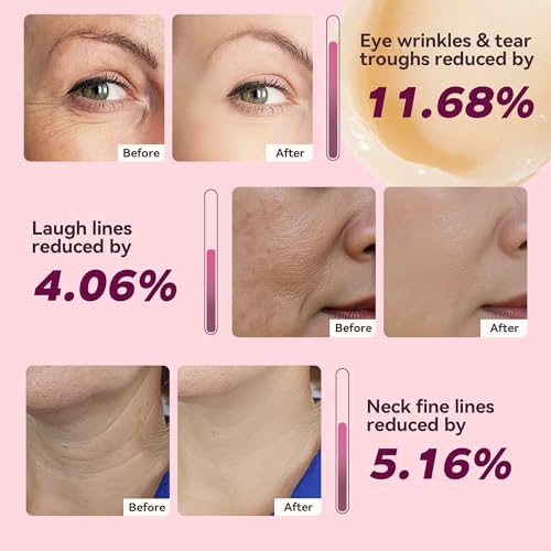 Fleur Luxxe Calcium Multi Balm autour des yeux, soin ciblé pour l'élasticité et l'éclat.