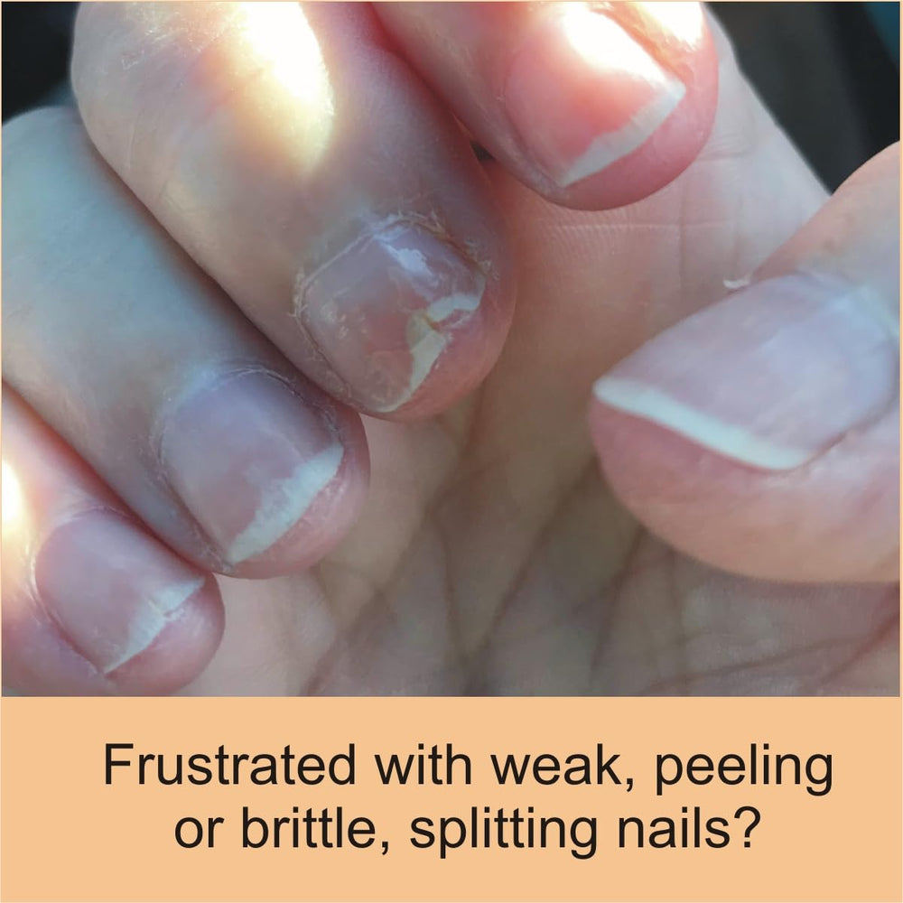 FlexiNail renforce les ongles faibles et fragiles, utilisation quotidienne.