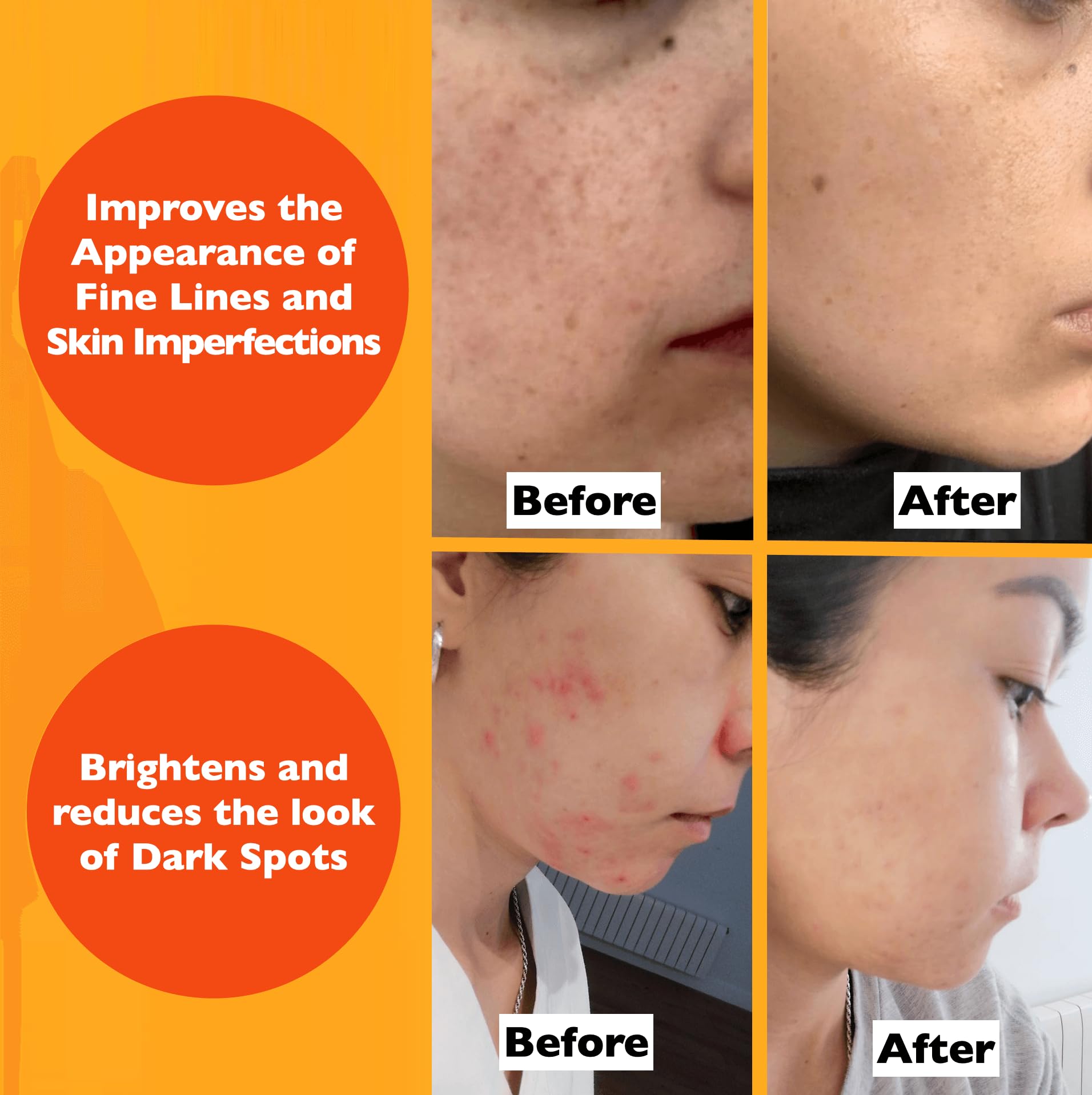 Florence Sérum vitamine C — soin visage contour des yeux pour le confort et la fermeté.