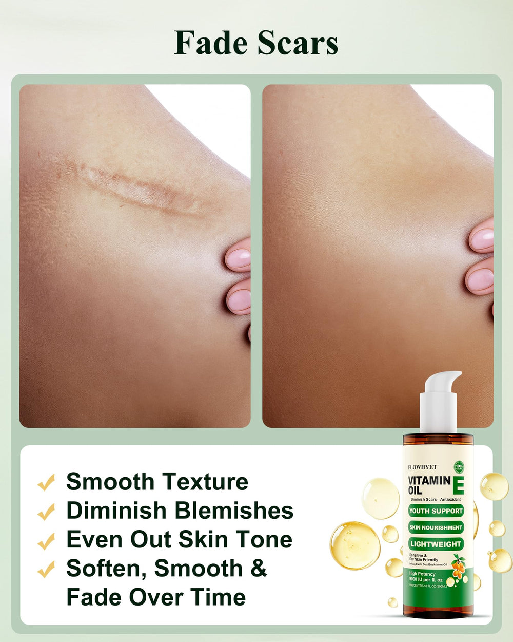 FLOWHYET huile vitamine E pour cheveux, nourrissante et hydratante.