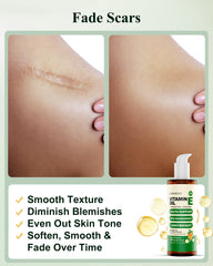 FLOWHYET huile vitamine E pour cheveux, nourrissante et hydratante.