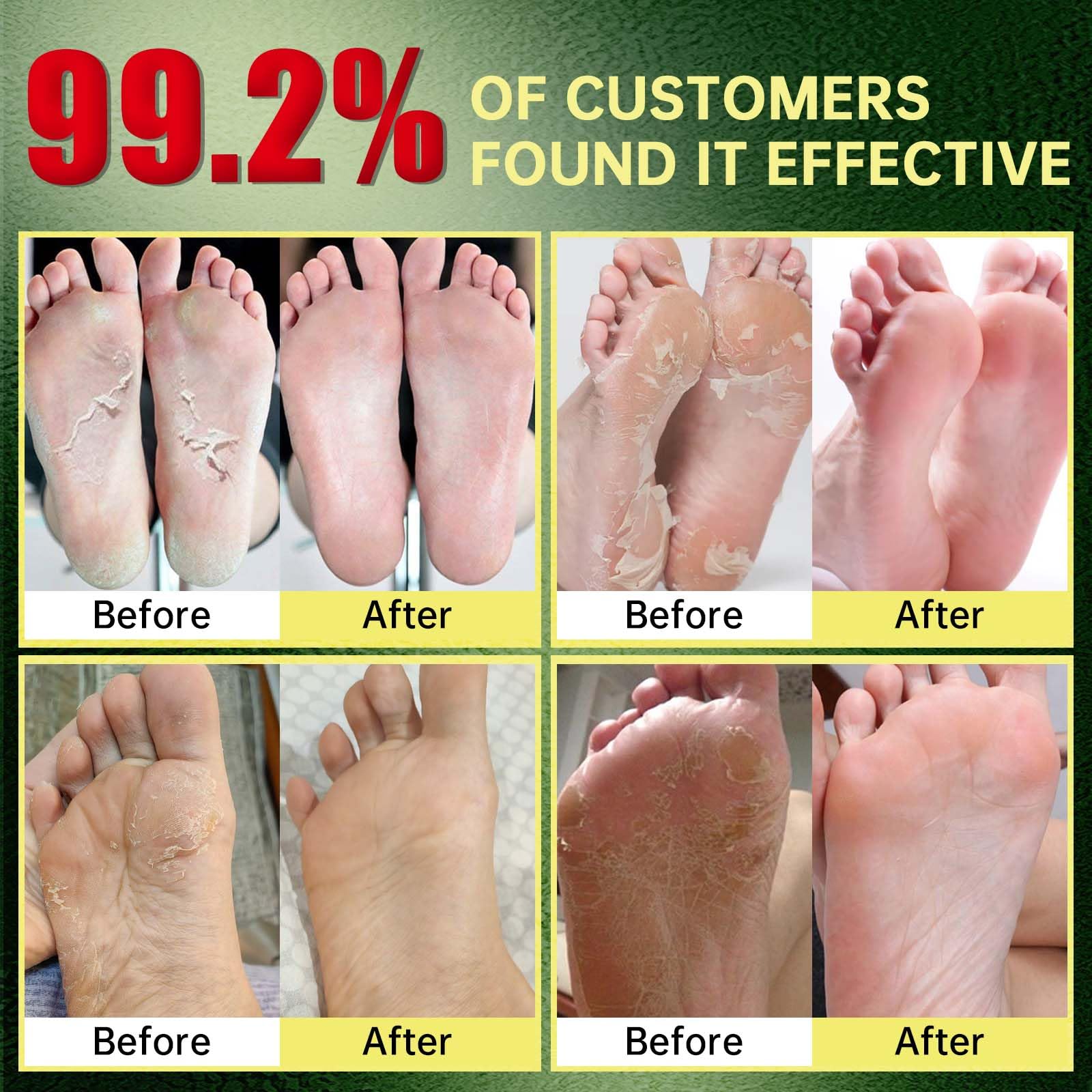 FLYLEAF Masque Exfoliant Pieds – application facile pour un soin sans effort