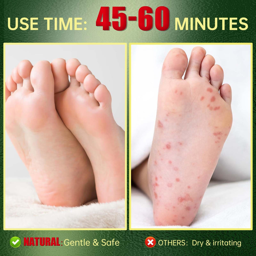 FLYLEAF Masque Exfoliant Pieds – après utilisation pieds plus doux et lisses