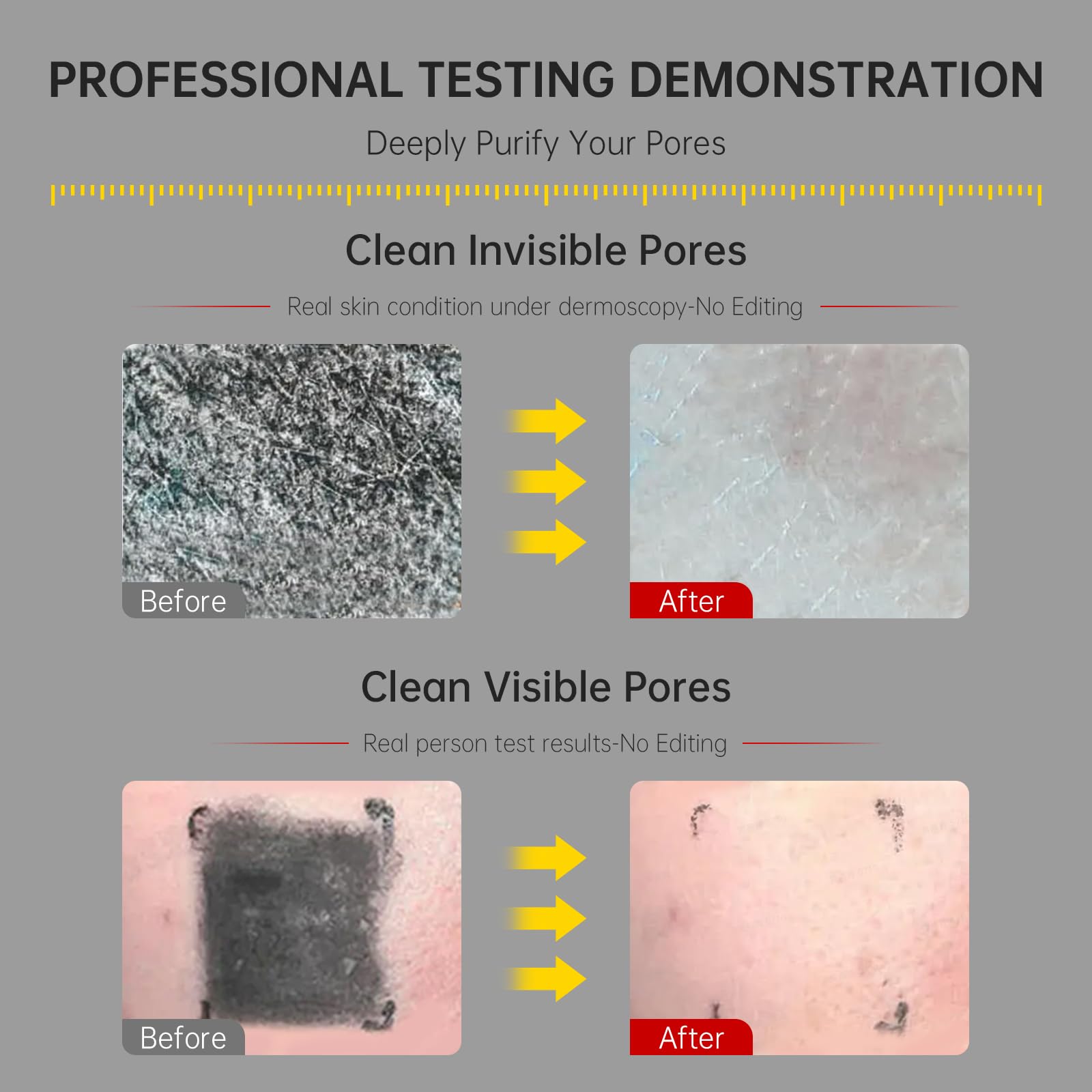 FLYLEAF Purification profonde des pores et points noirs sans dessèchement