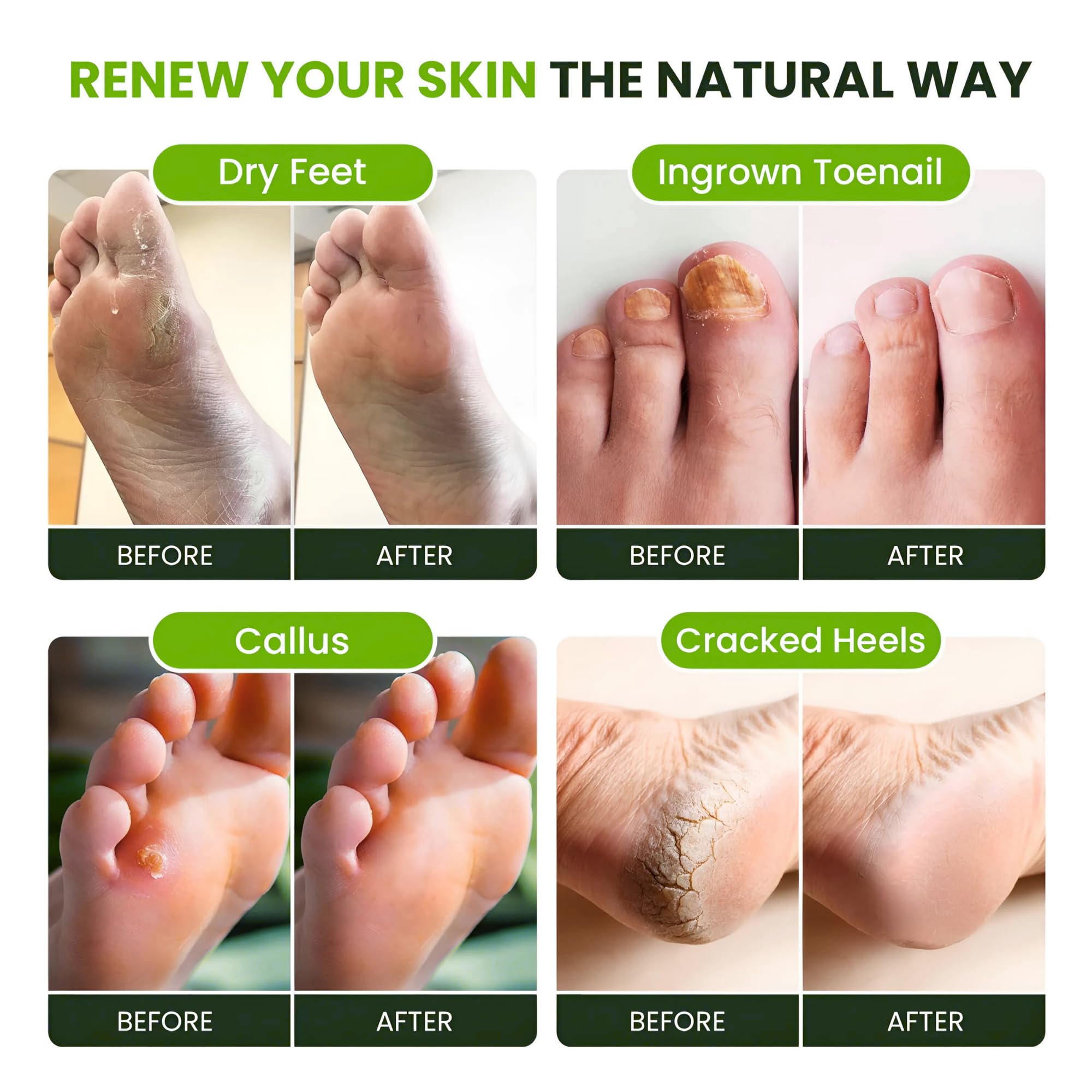 Foot Cure Herbal blend image shows natural aromatics for calming feet.