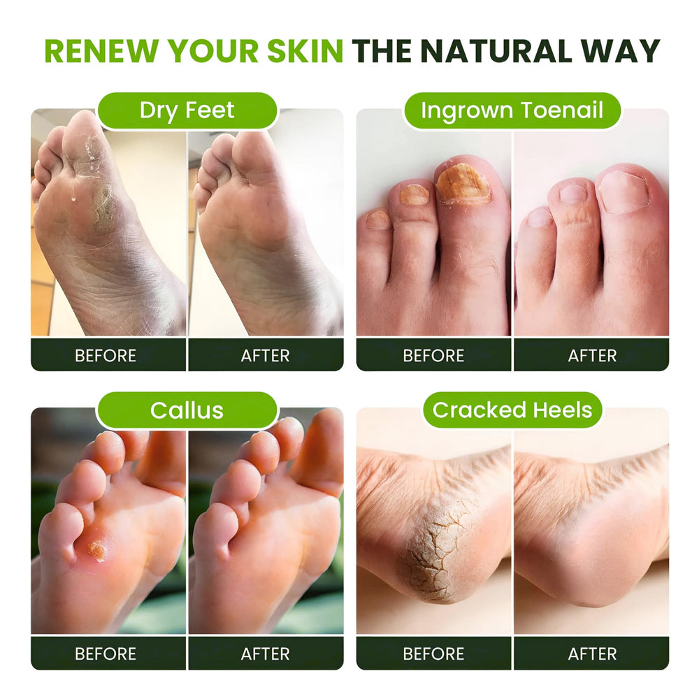 Foot Cure Herbal blend image shows natural aromatics for calming feet.