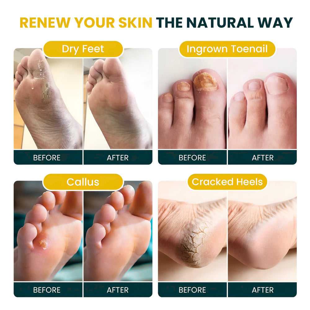 Foot Cure huile de coco bio et agrumes pour nourrir la peau.