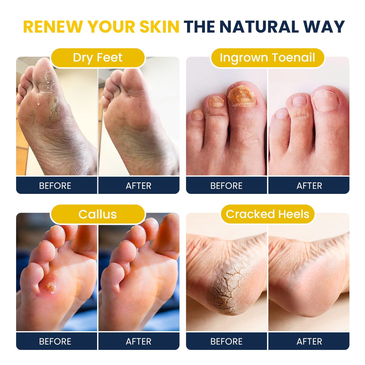 Foot Cure ingrédients-epsom-sels-mer: action purifiante pour une peau nette.