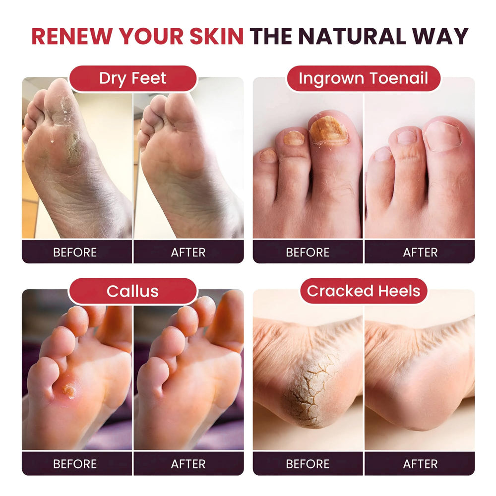 FOOT CURE: emballage-paquet-deux-bains-pieds