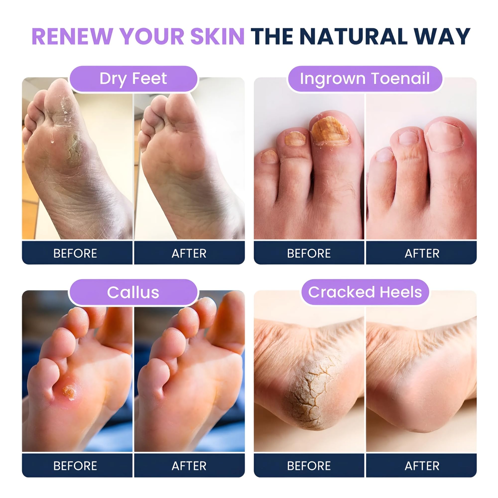 FOOT CURE peau douce après immersion et massage léger