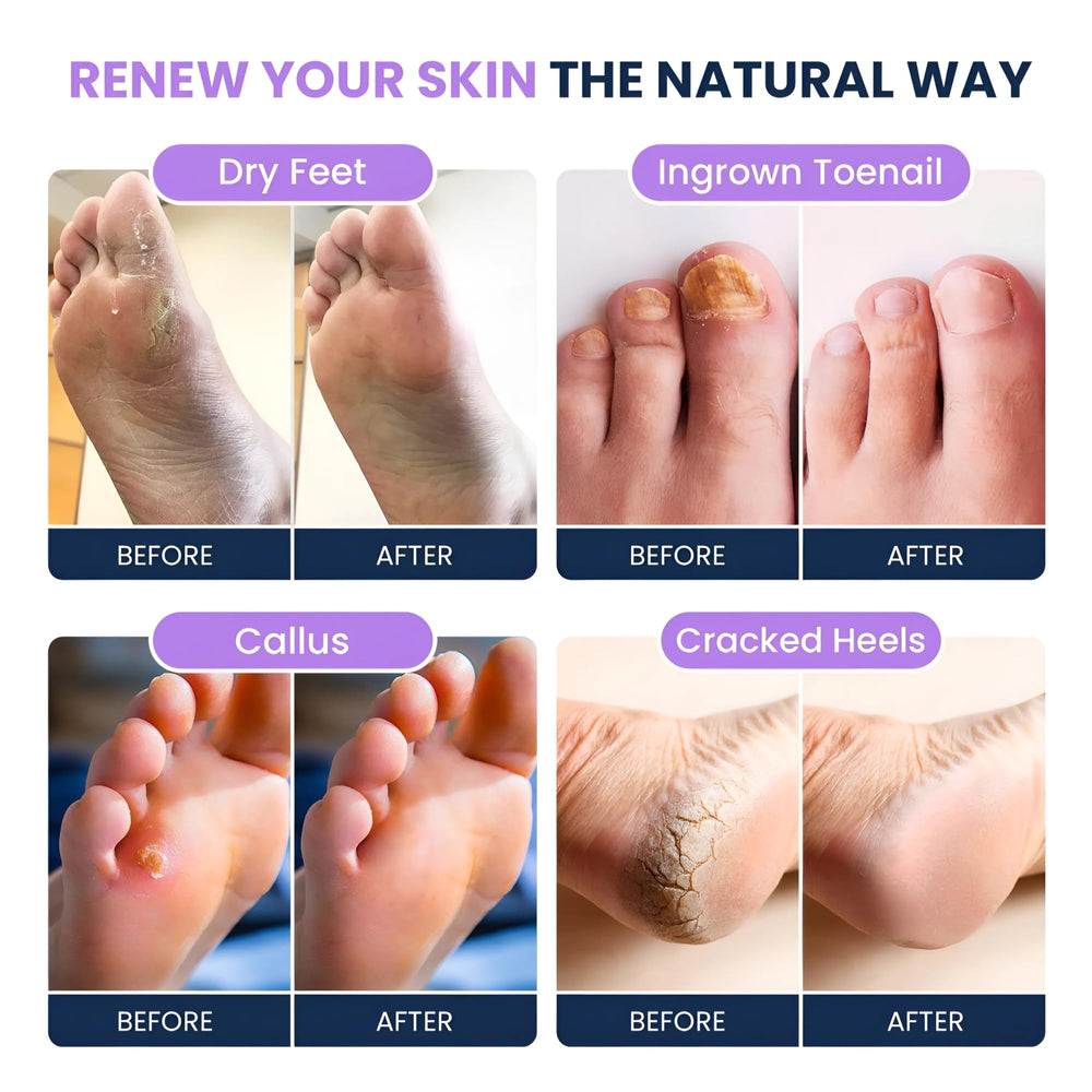 FOOT CURE peau douce après immersion et massage léger