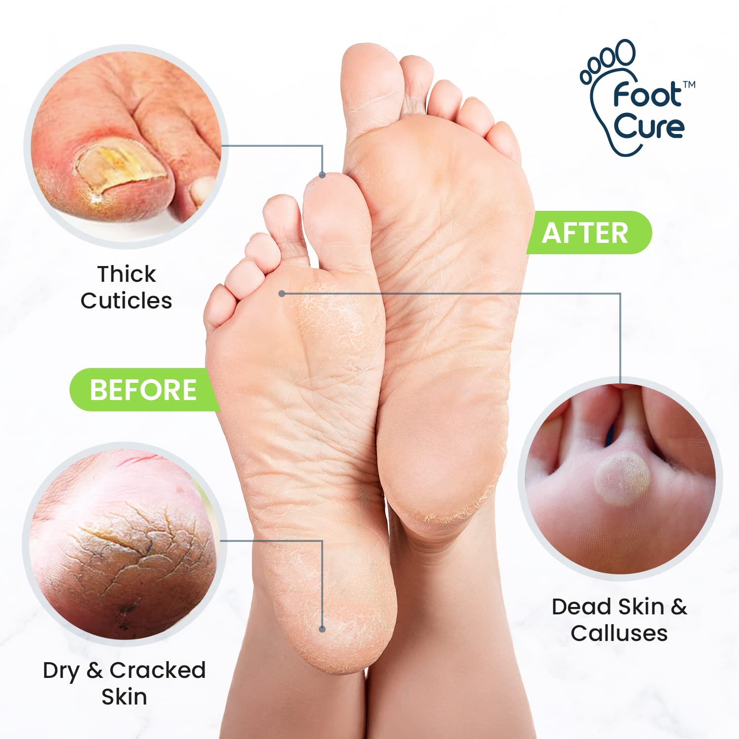 Foot Cure sels-epsom-pieds, expérience spa à la maison