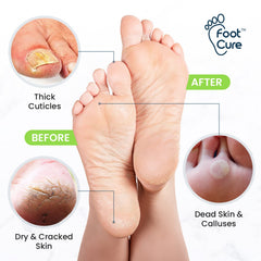 Foot Cure sels-epsom-pieds, expérience spa à la maison