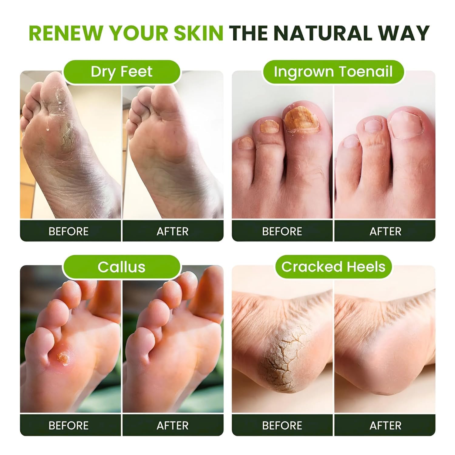 FOOT CURE spa-pieds relaxation avant l ete