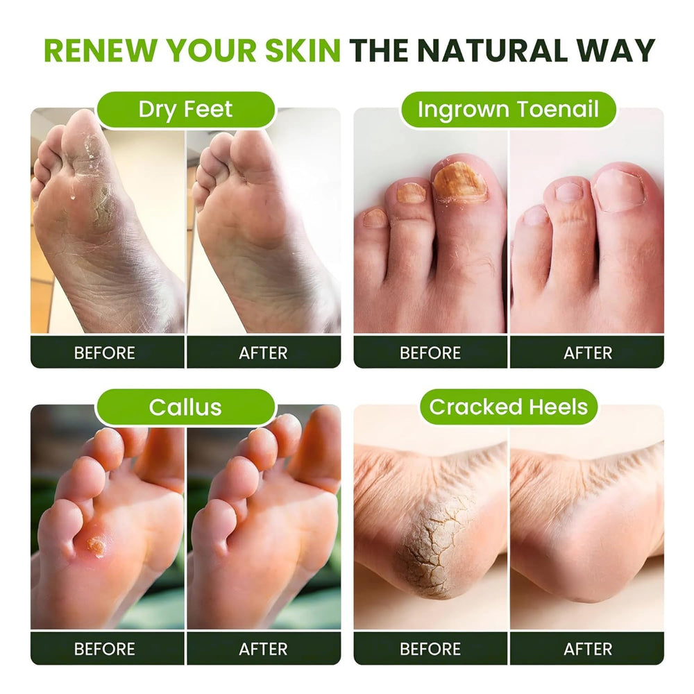 FOOT CURE spa-pieds relaxation avant l ete