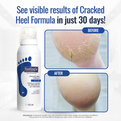 Footlogix huile primrose améliore la structure cutanée et la souplesse.