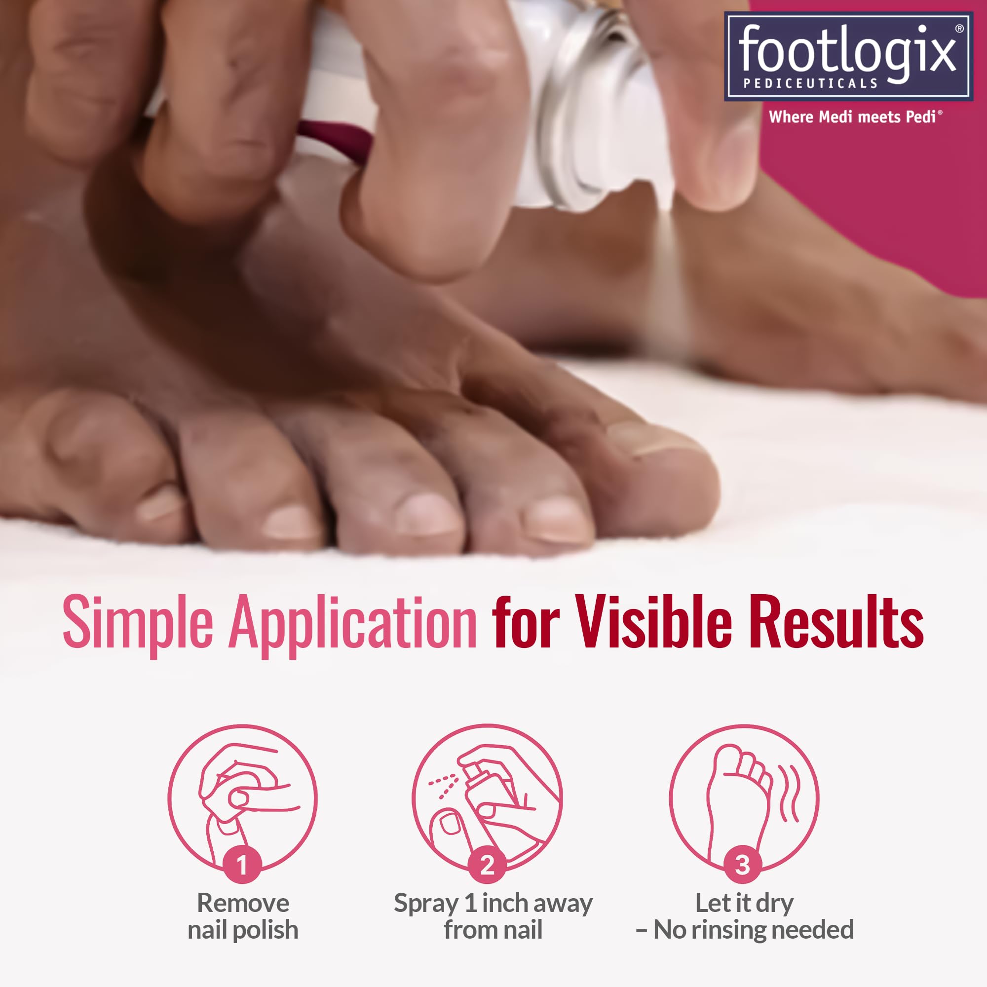 Footlogix Nail Tincture Spray Spiraleen – emballage élégant et pratique à conserver.