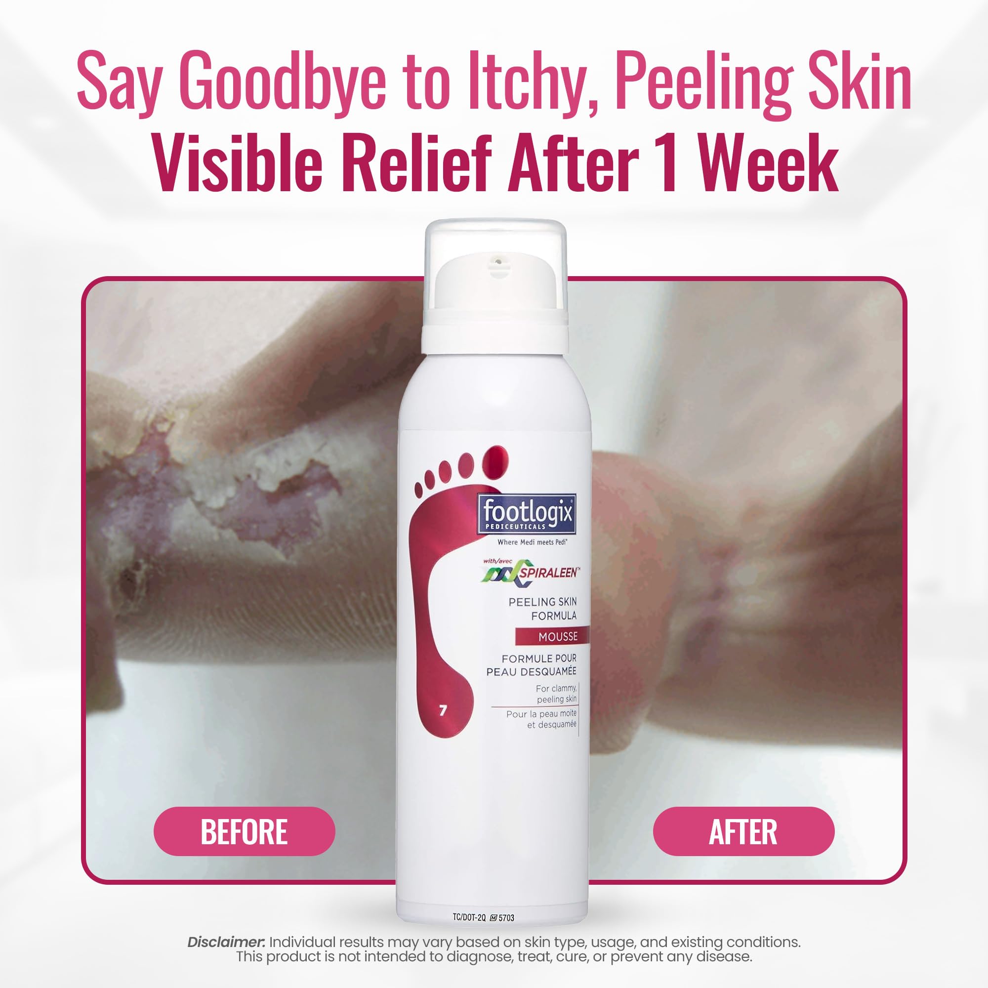 Texture légère FOOTLOGIX facilitant l exfoliation et le soin des pieds.