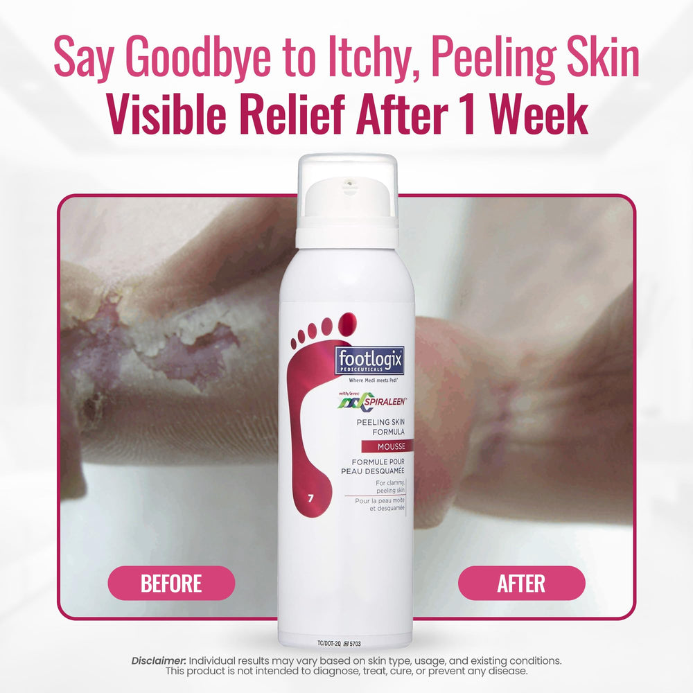 Texture légère FOOTLOGIX facilitant l exfoliation et le soin des pieds.