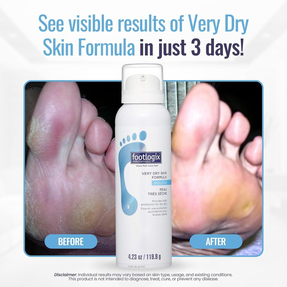 Footlogix Très Sèche – Pieds en douceur grâce à une texture crémeuse.