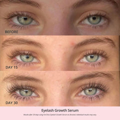 ForChics Sérum Cils — applicateur fin guidant la ligne des cils avec précision.
