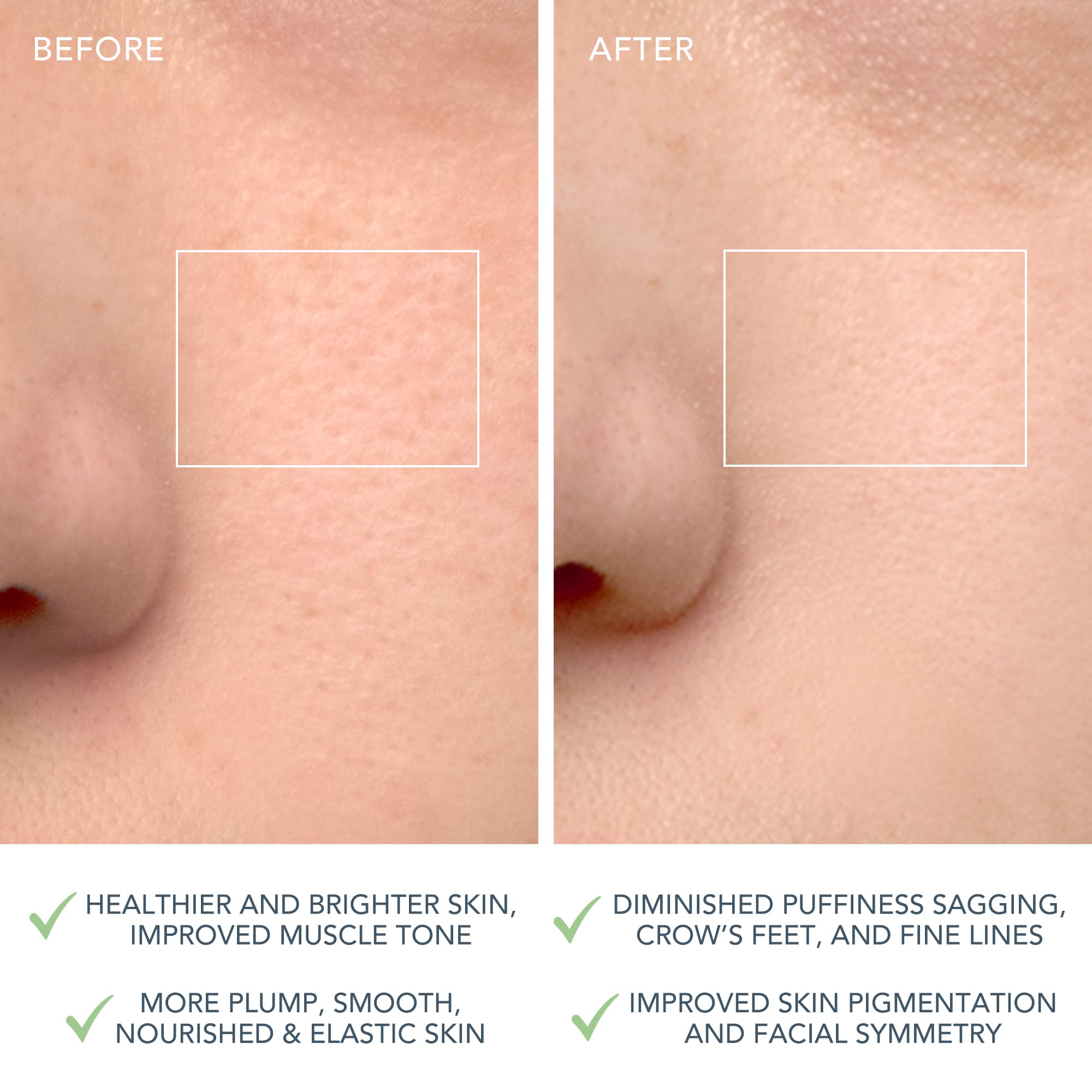 FOREO LUNA 4 prépare l’absorption des soins grâce à une exfoliation douce