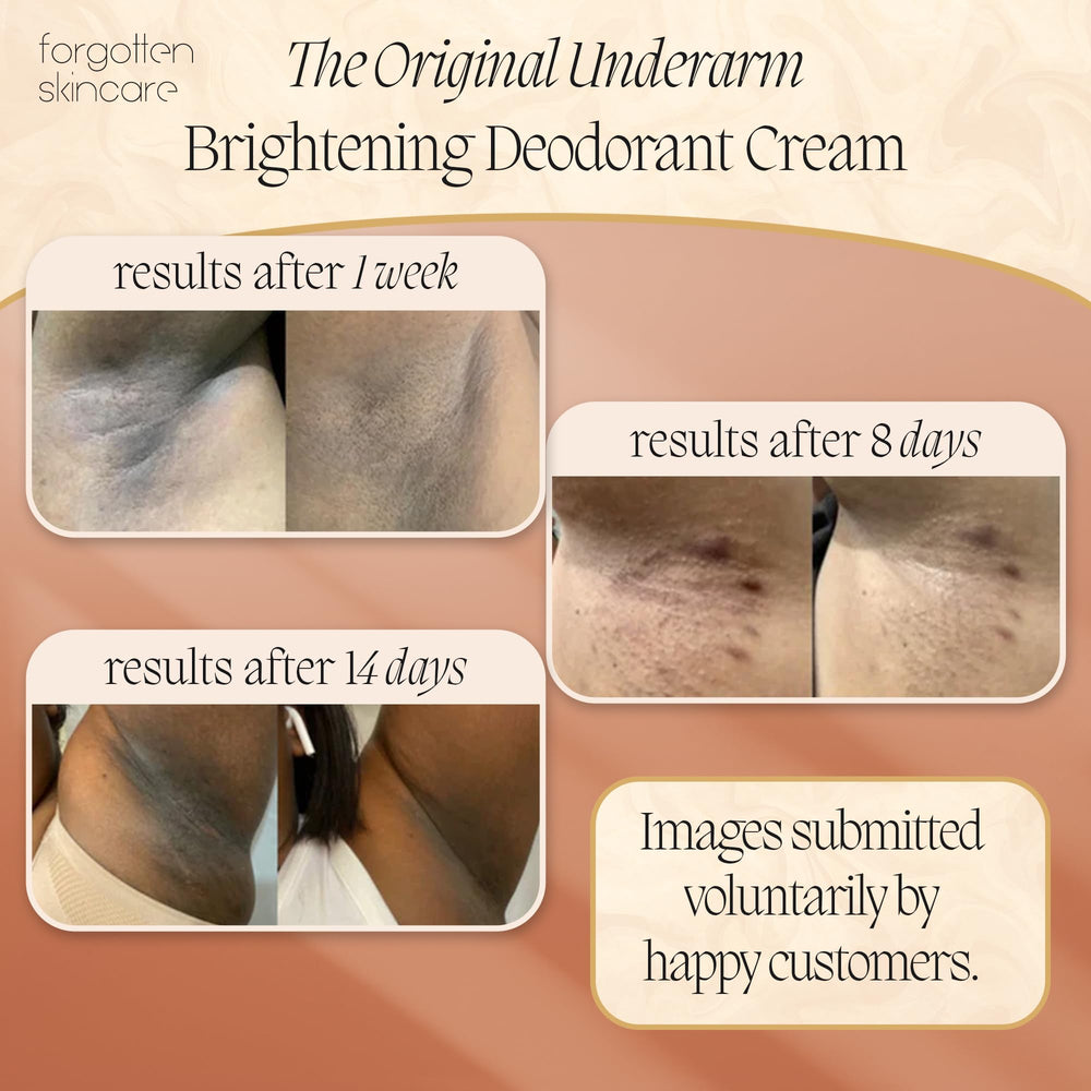 Application rituelle de la crème éclaircissante Forgotten Skincare.