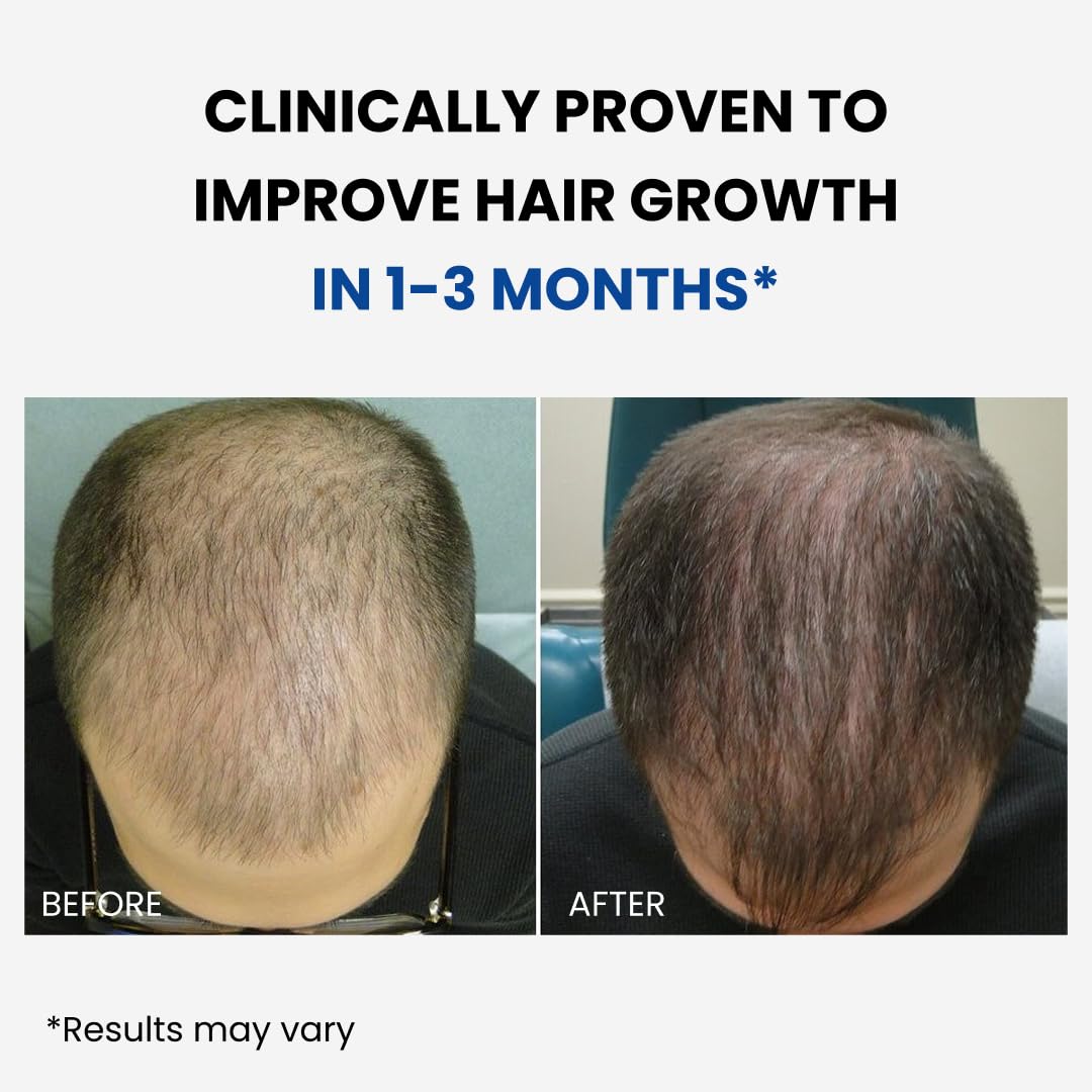 ForHair-appli-cuir-chevelu : application ciblée sur le cuir chevelu, sans résidu gras.