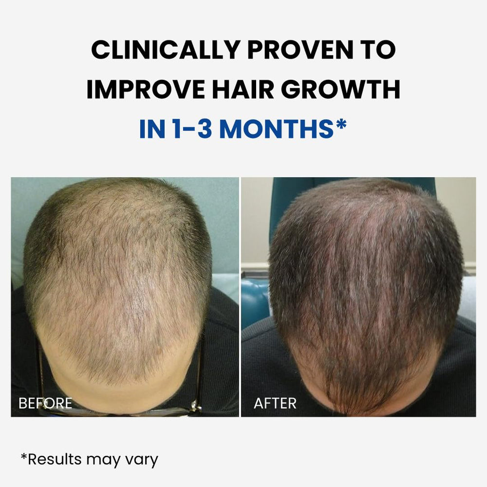 ForHair-appli-cuir-chevelu : application ciblée sur le cuir chevelu, sans résidu gras.