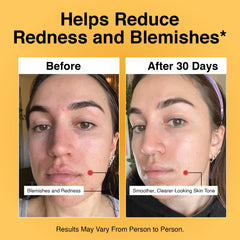 Foundation Skincare texture-peau-lisse: peau visiblement plus lisse jour après jour.