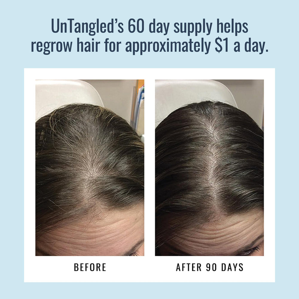 Foundation Skincare UnTangled: aperçu avant-apres capillaire, exemple potentiel de résultats
