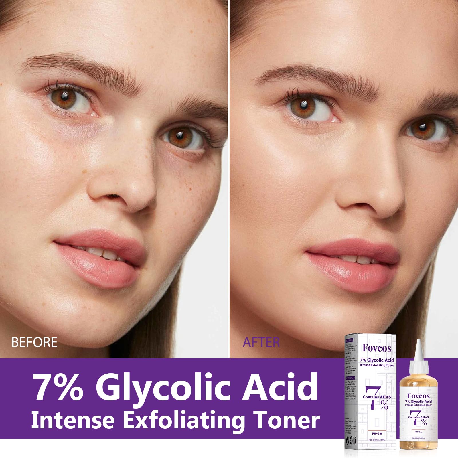 Application sur coton avec le tonique Fovcos pour pores propres