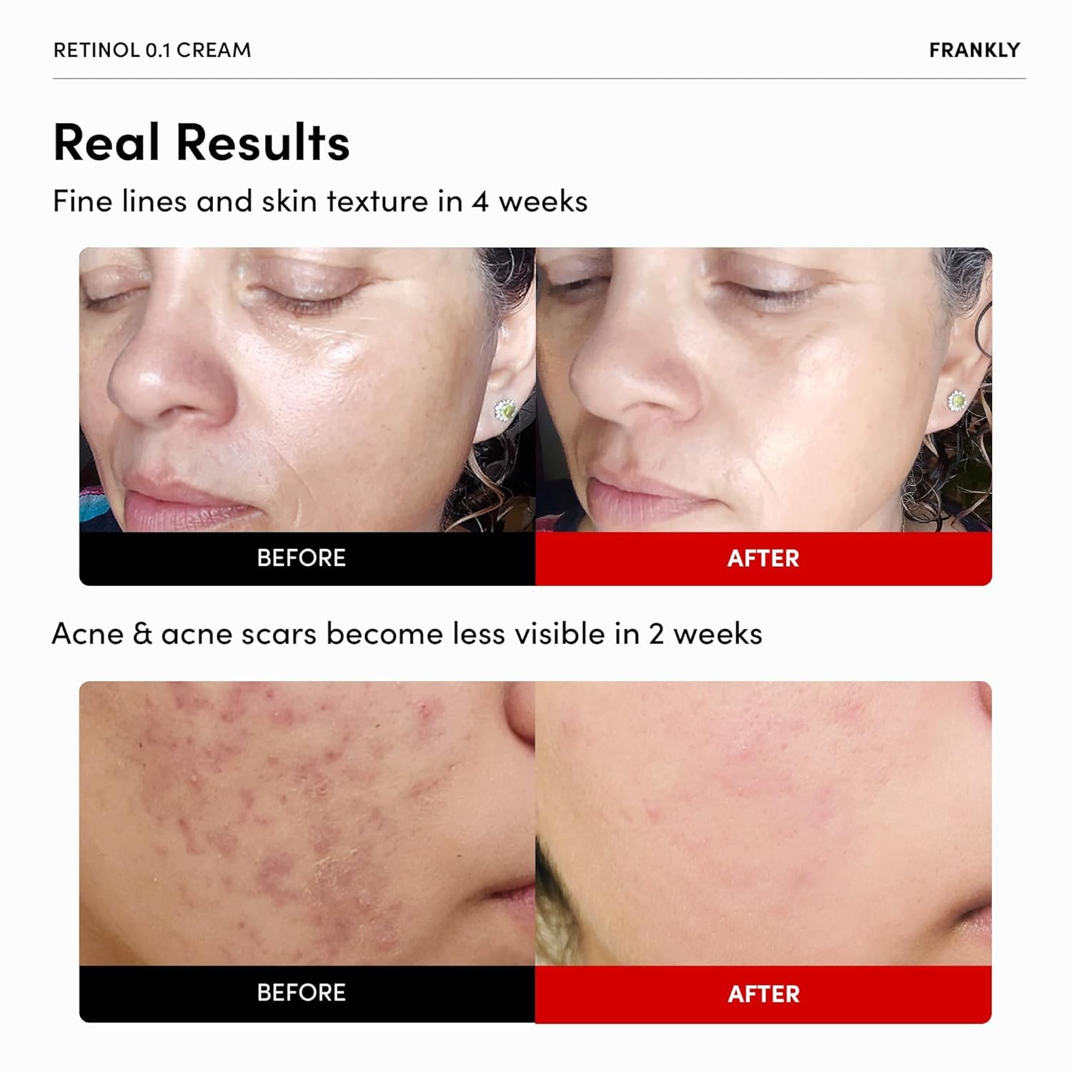 FRANKLY Crème visage ceramides et ginseng: hydratation durable et confort.