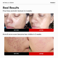 FRANKLY Crème visage ceramides et ginseng: hydratation durable et confort.