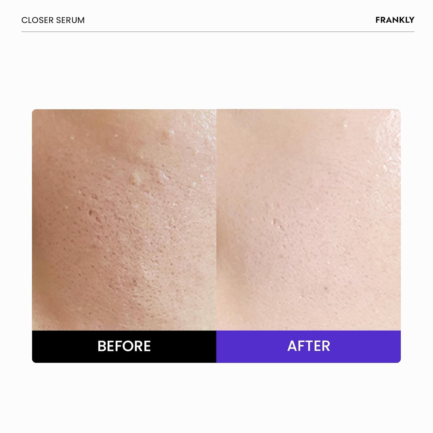 FRANKLY Closer Serum Jumbo — etiquette translucide inspirant transparence des ingrédients.
