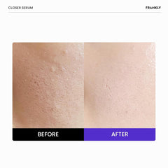 FRANKLY Closer Serum Jumbo — etiquette translucide inspirant transparence des ingrédients.